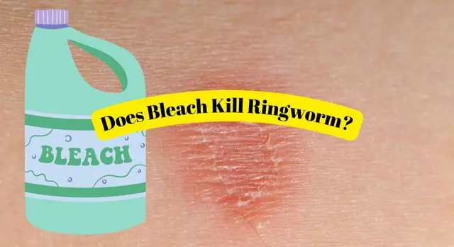 Does Bleach Kill Ringworm