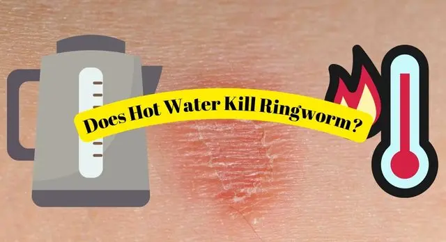 Does Hot Water Kill Ringworm